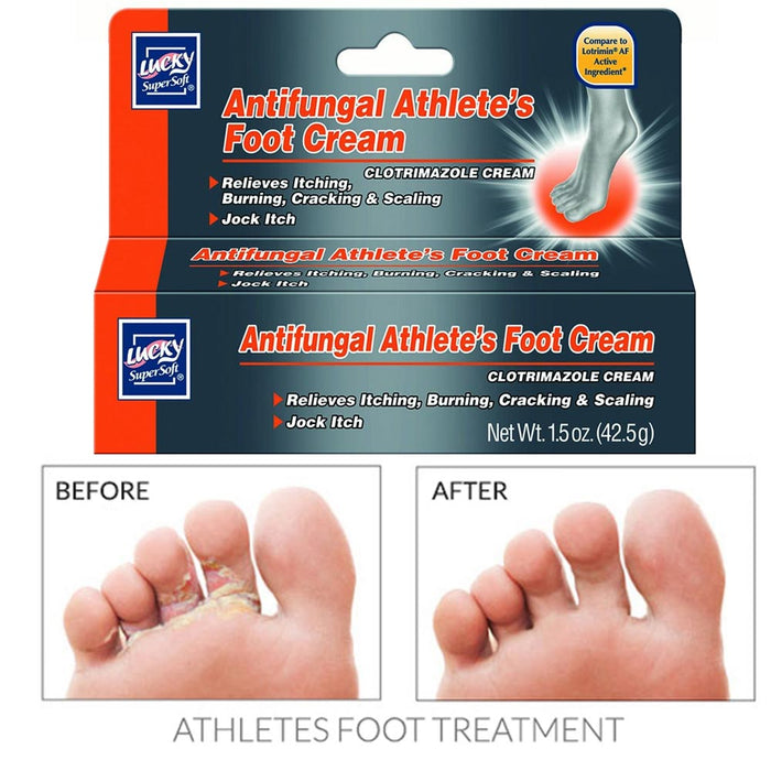 2X Antifungal Athletes Foot Cream Treatment Itching Burning Anti Fungus Relieves