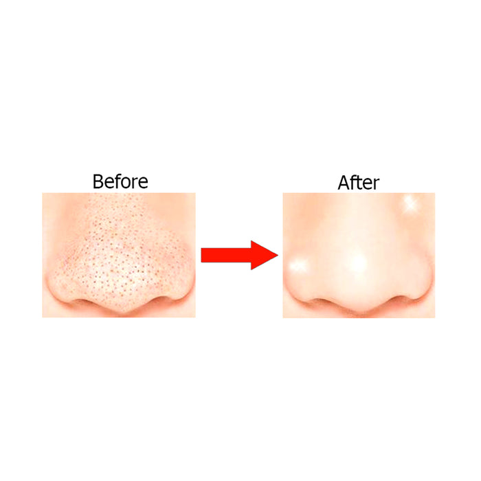 18 Nupore Nose Blackhead Remover Pore Strip Instant Blackhead Removal Unclogging
