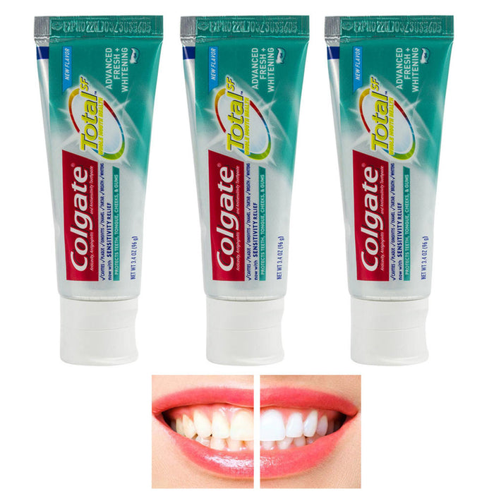 3 Pack Colgate Total Advanced Fresh Whitening Toothpaste Oral Health Tooth Paste