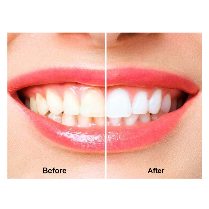 4 Colgate Toothpaste Teeth Whitening Baking Soda Peroxide Cavity Protection 4 Oz