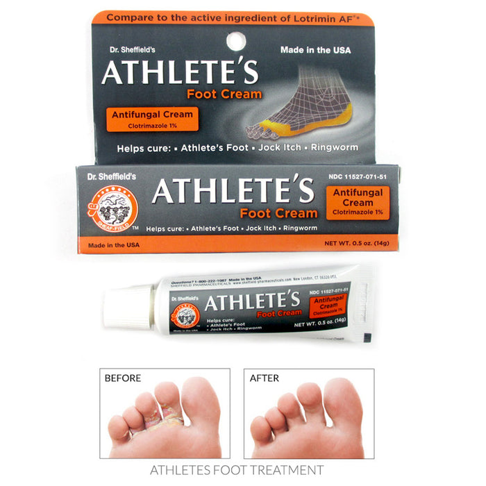 Athlete's Foot Antifungal Cream Treatment Jock Itch Ringworm Itching Anti Fungus