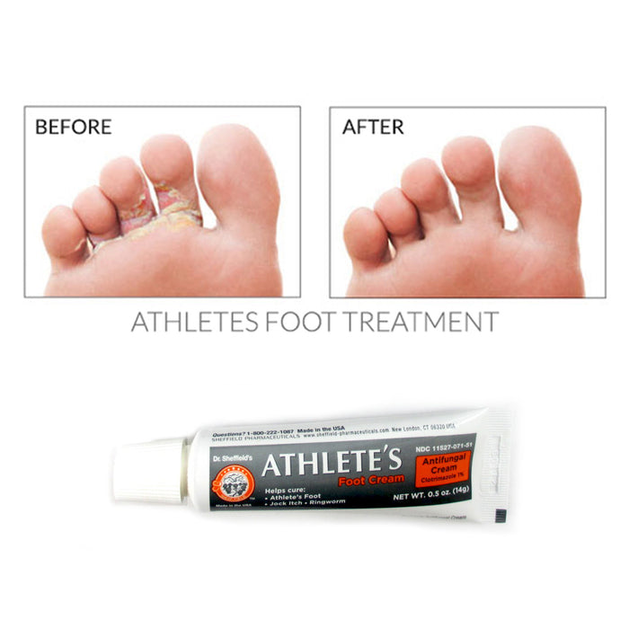 2 x Anti-Fungal Cream for Athletes Foot Antifungal 0.5 oz Ringworm Jock Itch