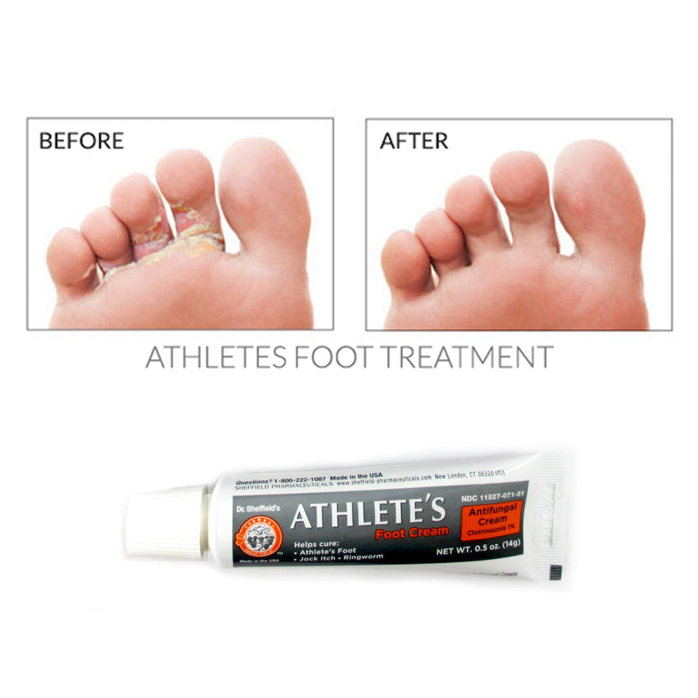 Foot Rash Cream 2 x Anti-Fungal Cream for Athletes Foot Antifungal 0.5 oz Ringworm Joc ...