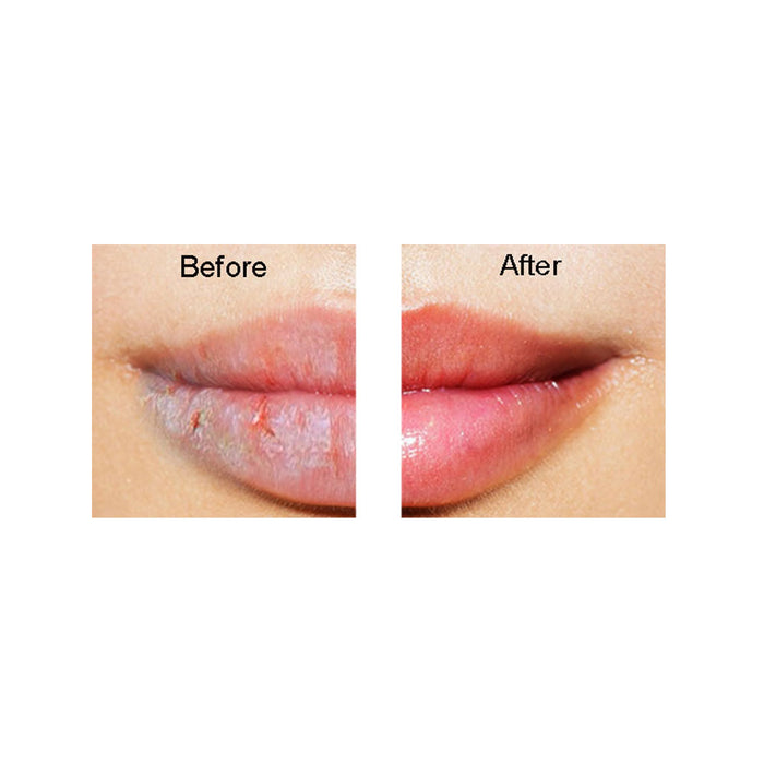 3 Pc Chap Ice Lip Treatment Therapy Balm 0.25 Oz Flavors Petroleum Jelly Lipbalm